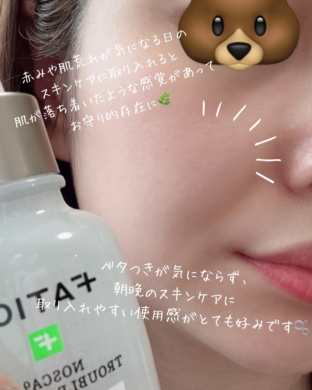 ノスカナイン トラブル セラム/FATION/美容液を使ったクチコミ（3枚目）