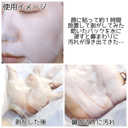 トラブルパッチマスク/EIOM/その他スキンケアを使ったクチコミ(5枚目)