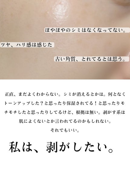 メラピールクリームマスク/CHARDE/ピーリングを使ったクチコミ(5枚目)