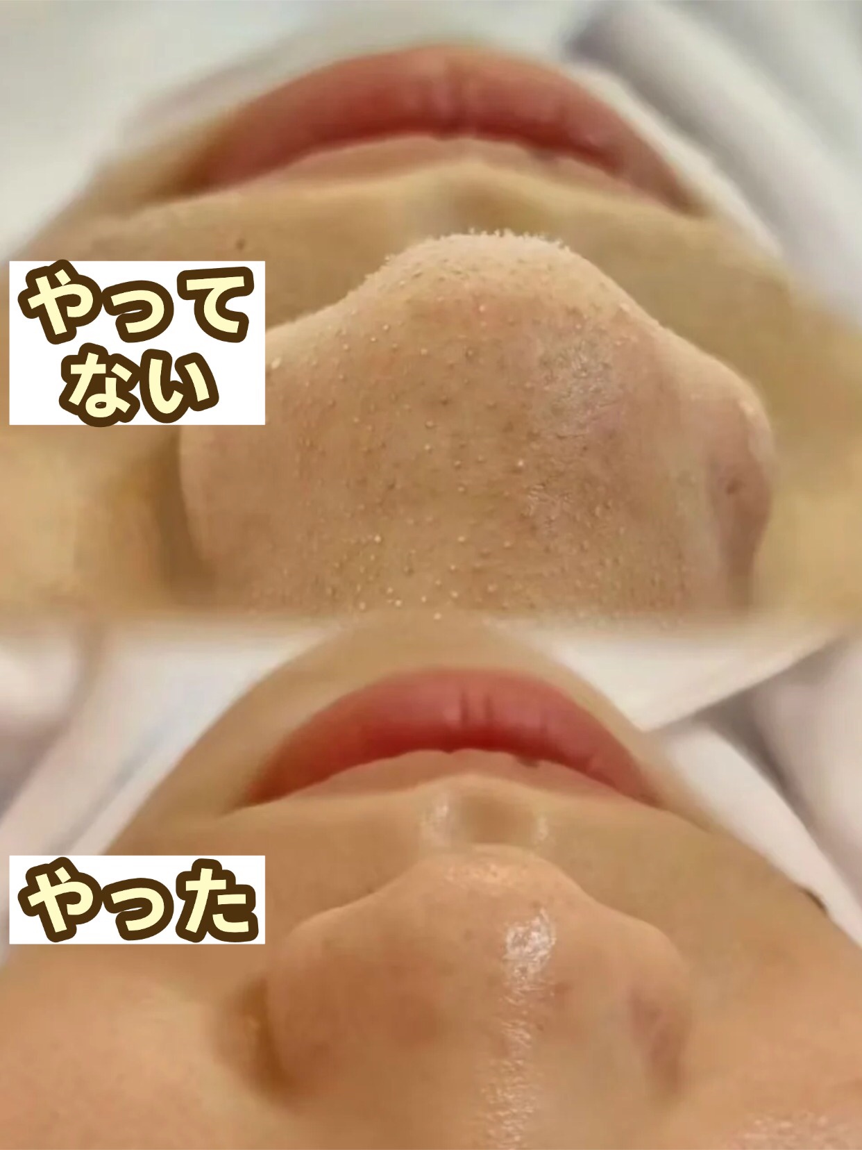 アネトス バランシング トリートメントクリーム/Anetos/フェイスクリームを使ったクチコミ（1枚目）