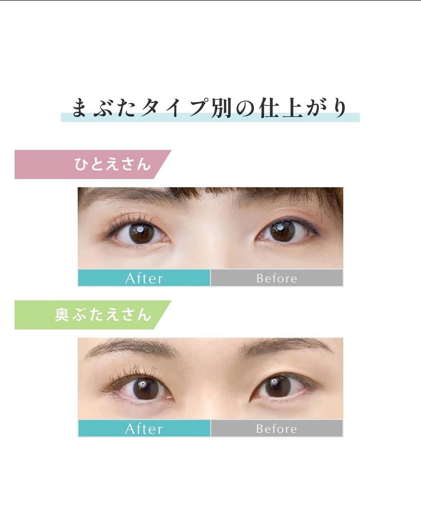 ひとえ・奥ぶたえ用カーラー/アイプチ®/ビューラーを使ったクチコミ(3枚目)