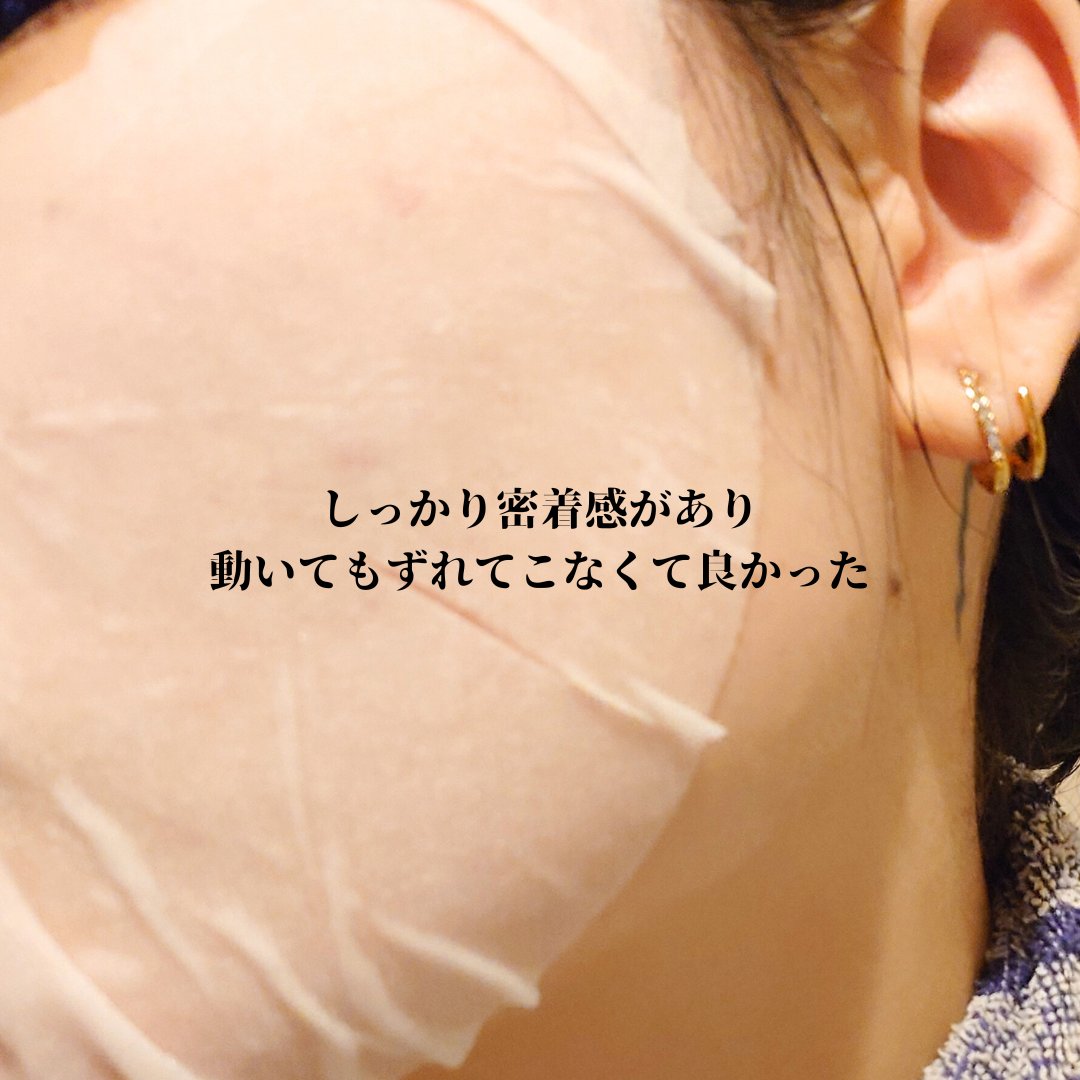 タカミ スキンピールマスク/タカミ/シートマスク・パックを使ったクチコミ（3枚目）