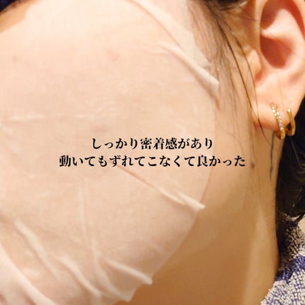 タカミ スキンピールマスク/タカミ/シートマスク・パックを使ったクチコミ(3枚目)