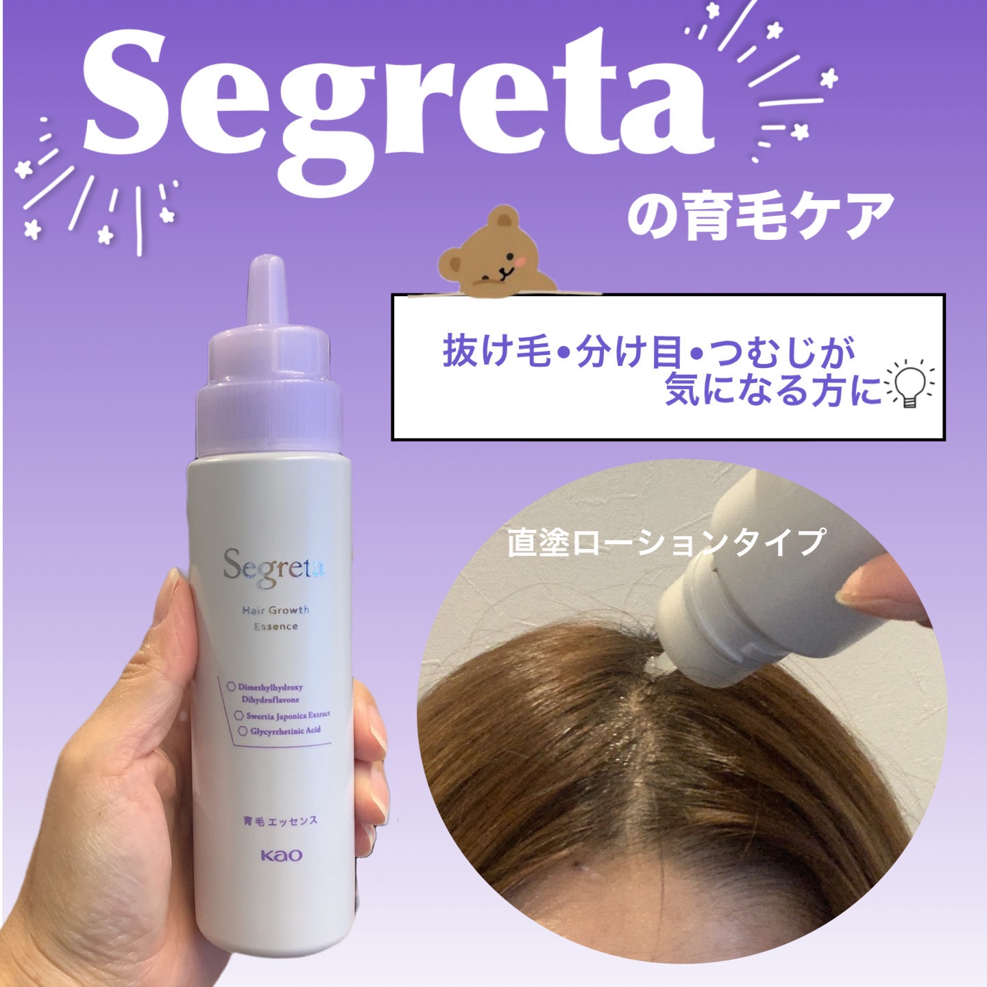 セグレタ 育毛エッセンス/花王/頭皮ローションを使ったクチコミ（1枚目）