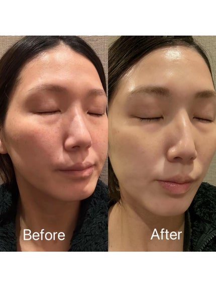 レッドコラーゲンハイドロゲルマスク/avajar/シートマスク・パックを使ったクチコミ(7枚目)