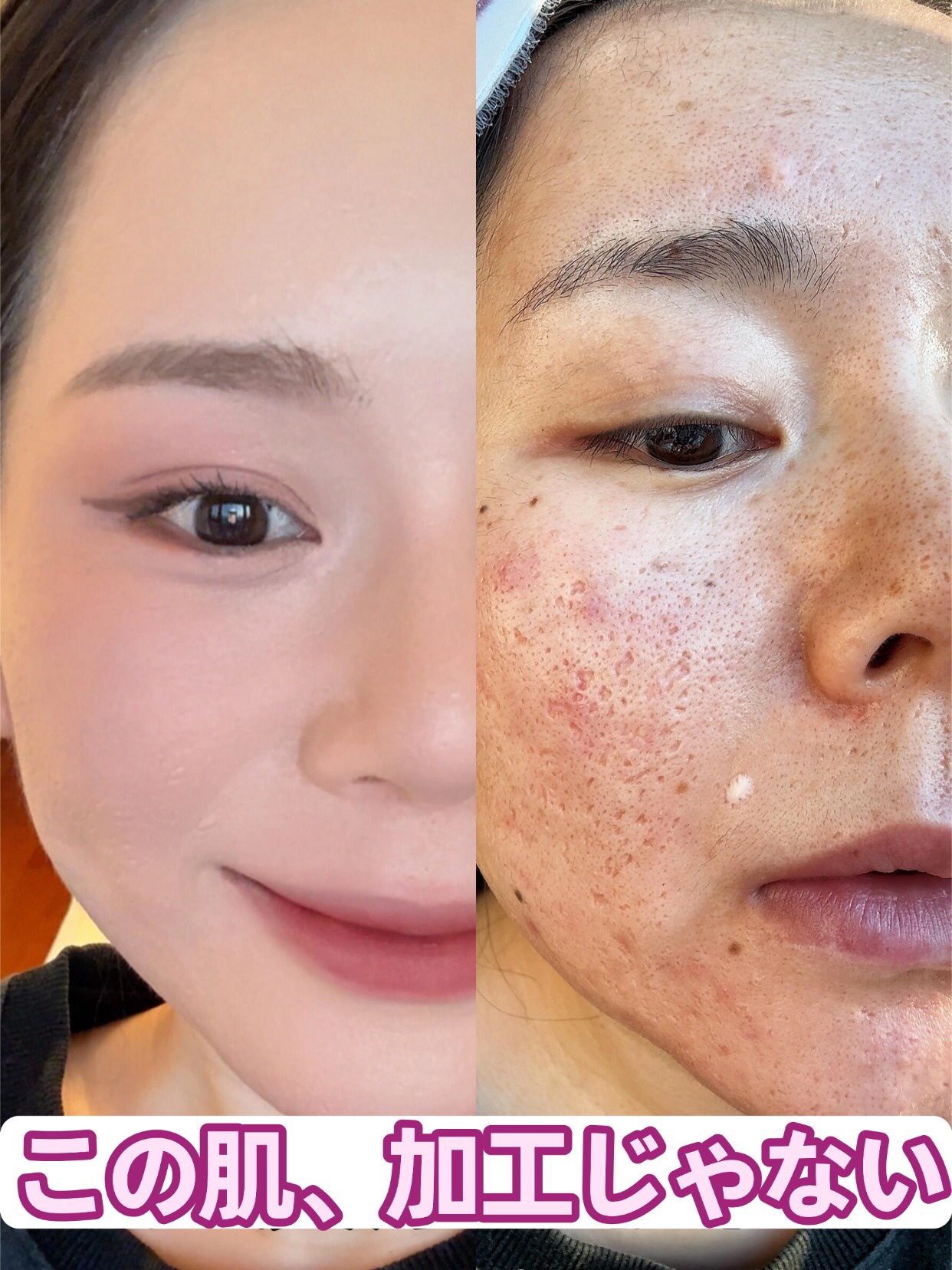 アネトス バランシング トリートメントクリーム/Anetos/フェイスクリームを使ったクチコミ（1枚目）