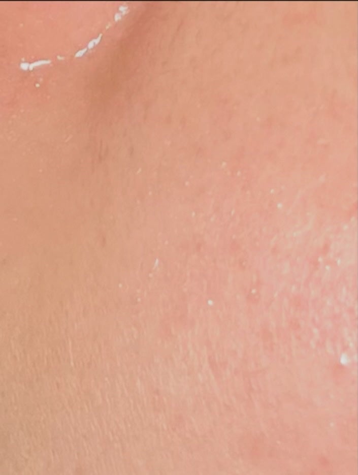 ハーブピーリング/on:myskin/ピーリングを使ったクチコミ(4枚目)