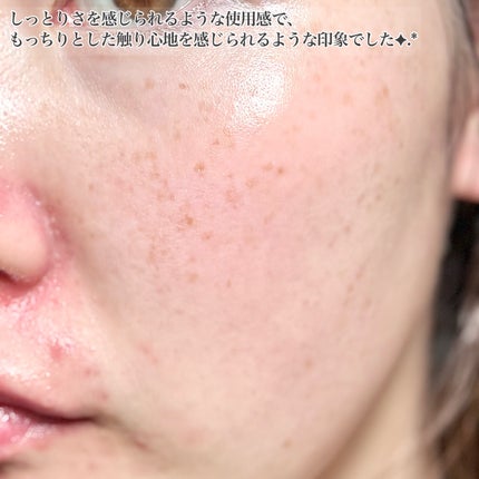 p/d 洗い流さない濃密泡パック/p/d/その他スキンケアを使ったクチコミ(8枚目)