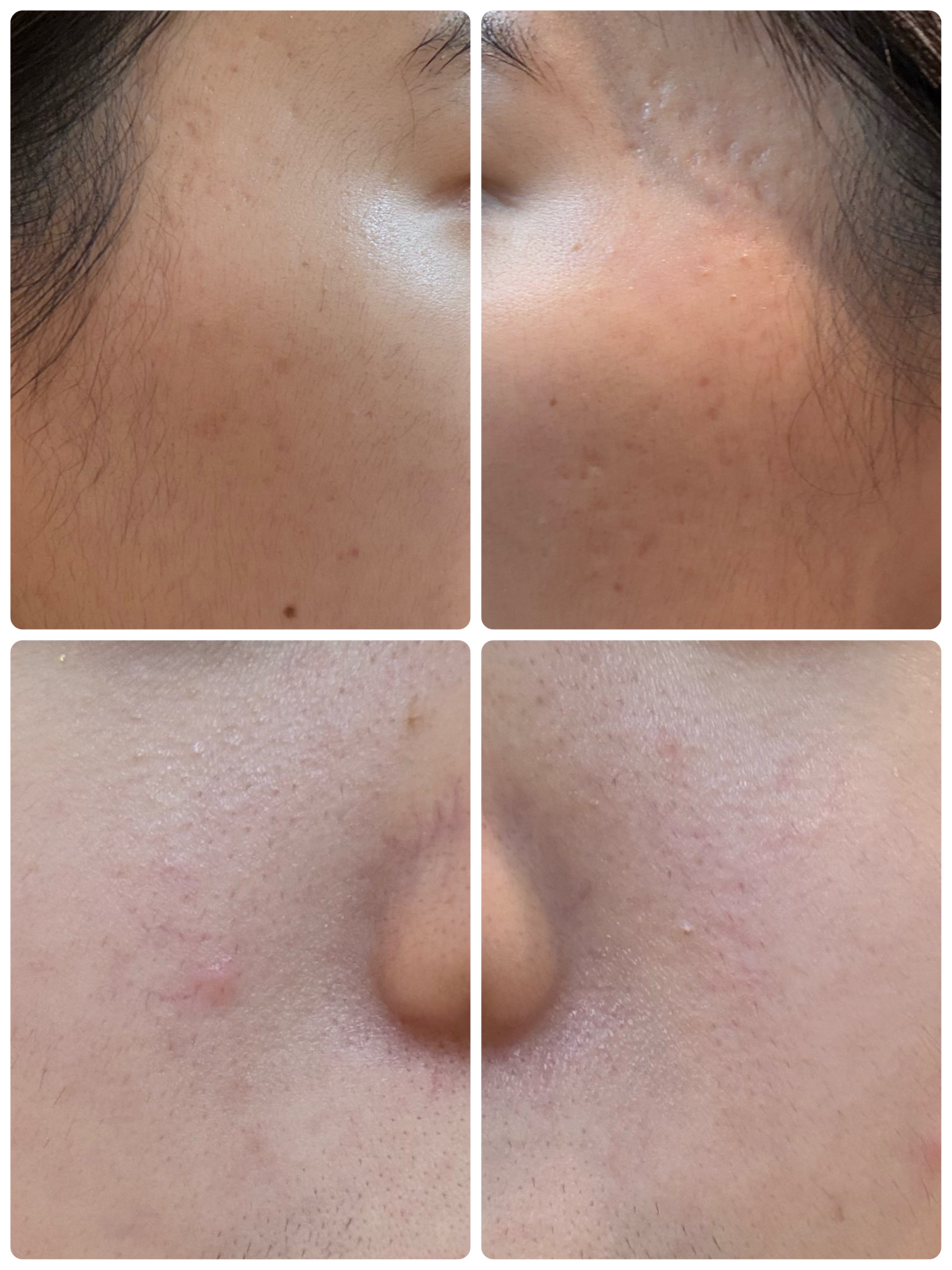 ディズム EMS EER メディスキンケアデバイス/DISM/美顔器・マッサージを使ったクチコミ（2枚目）