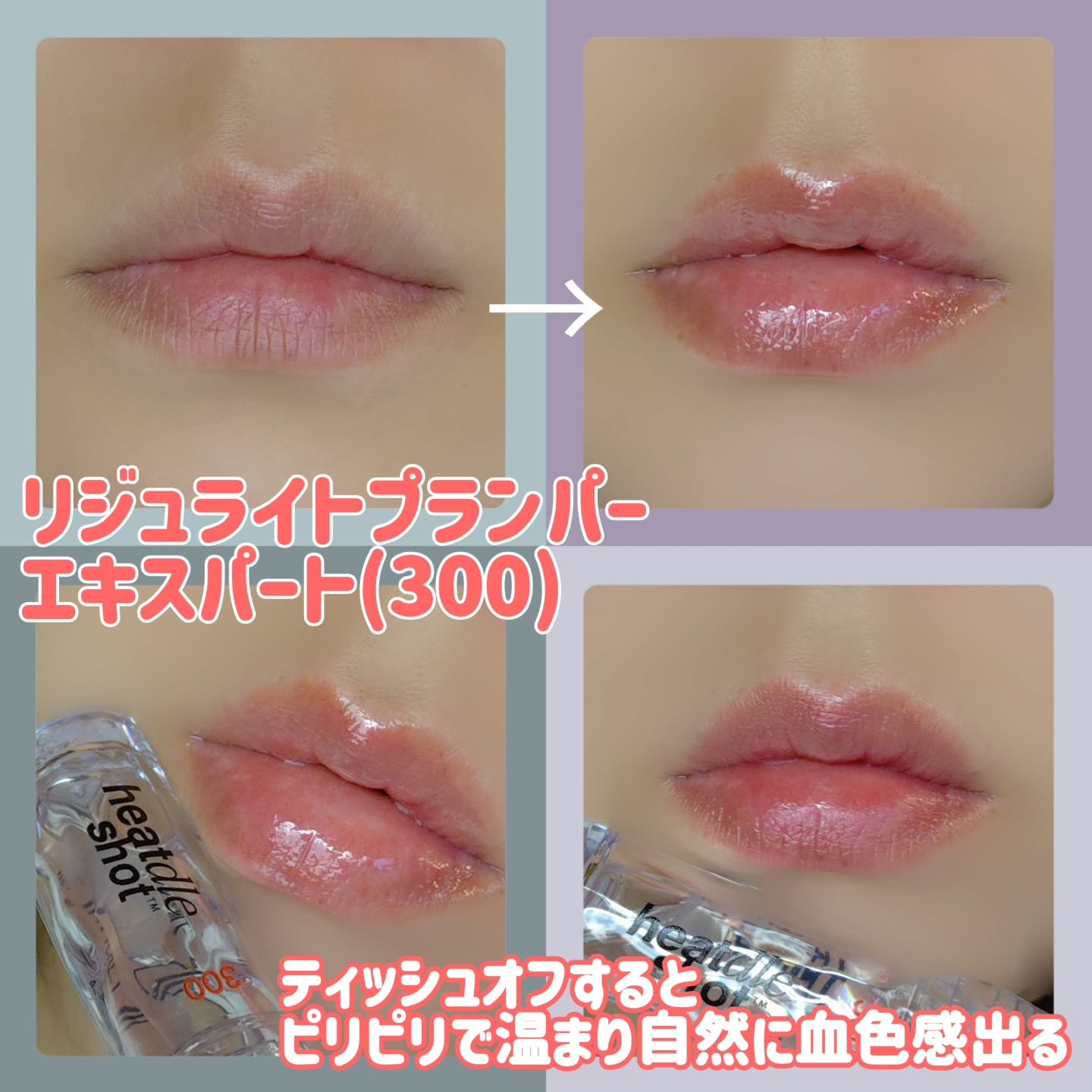 リジュライトプランパー ビギナー/BabyBright/リッププランパーを使ったクチコミ（2枚目）