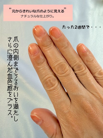 001 ヴィーガンティンテッドネイルハードナー/FOIND/ネイル用品を使ったクチコミ(3枚目)