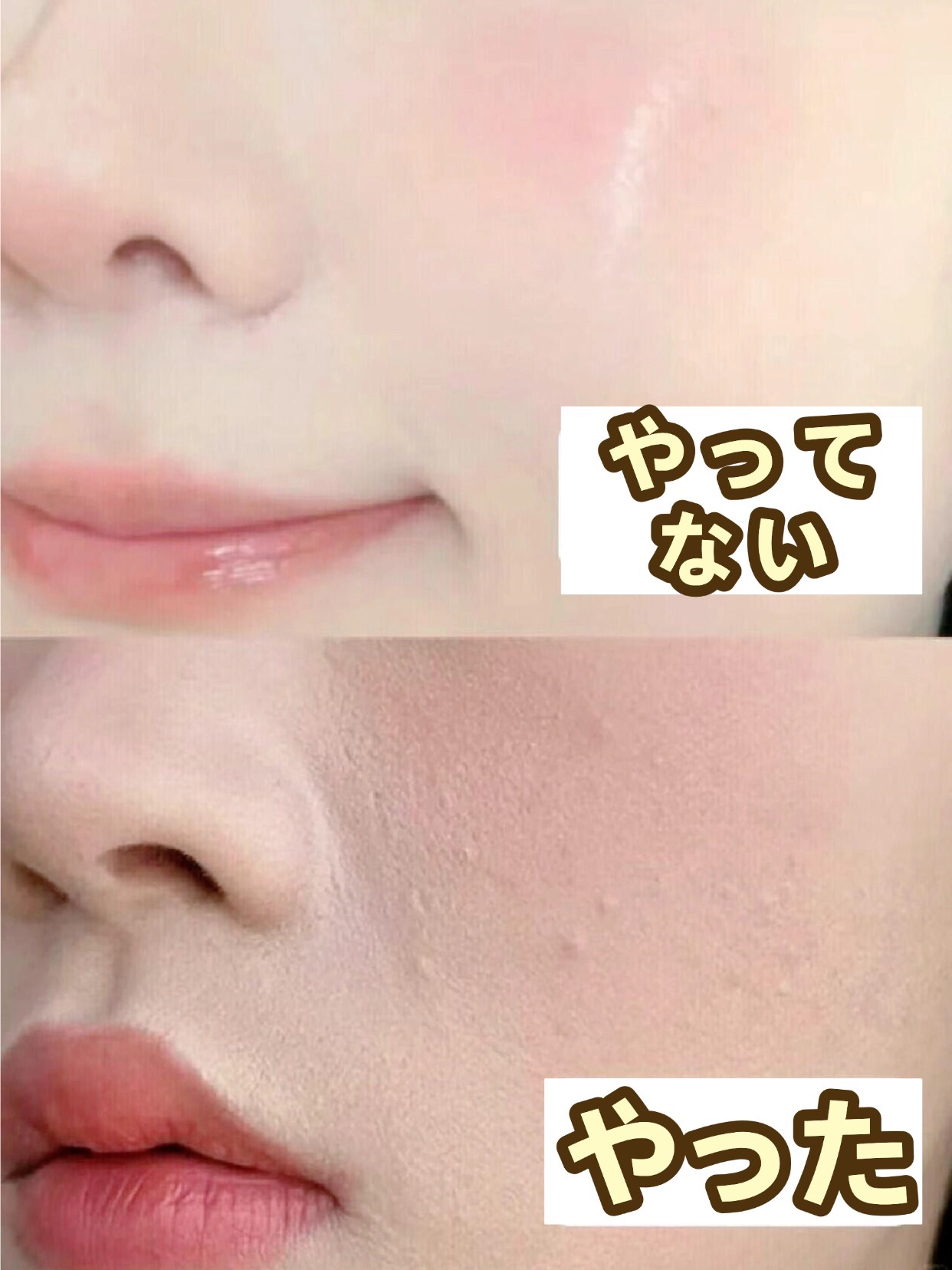 アネトス バランシング トリートメントクリーム/Anetos/フェイスクリームを使ったクチコミ（1枚目）