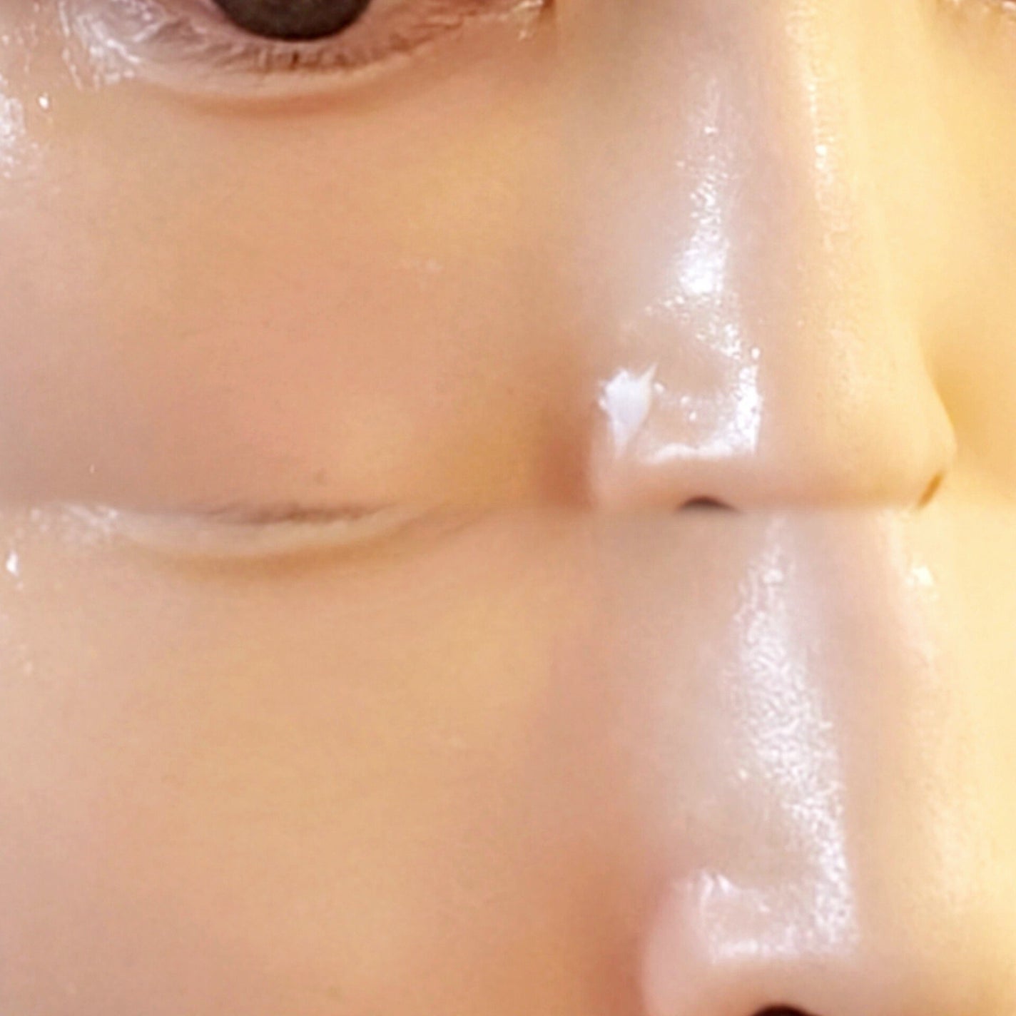 ダーマセプトRX AZAセラム/ダーマセプトRX/美容液を使ったクチコミ(3枚目)