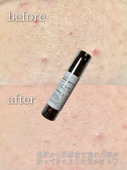 リードルショット100/VT/美容液を使ったクチコミ(4枚目)