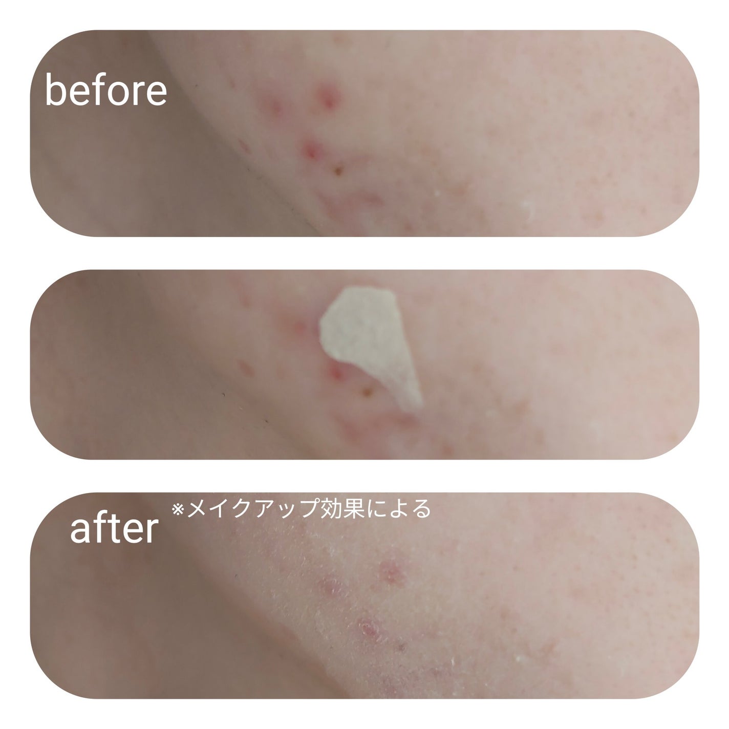 コンシーラー/FUNNY ELVES方里/リキッドコンシーラーを使ったクチコミ(3枚目)