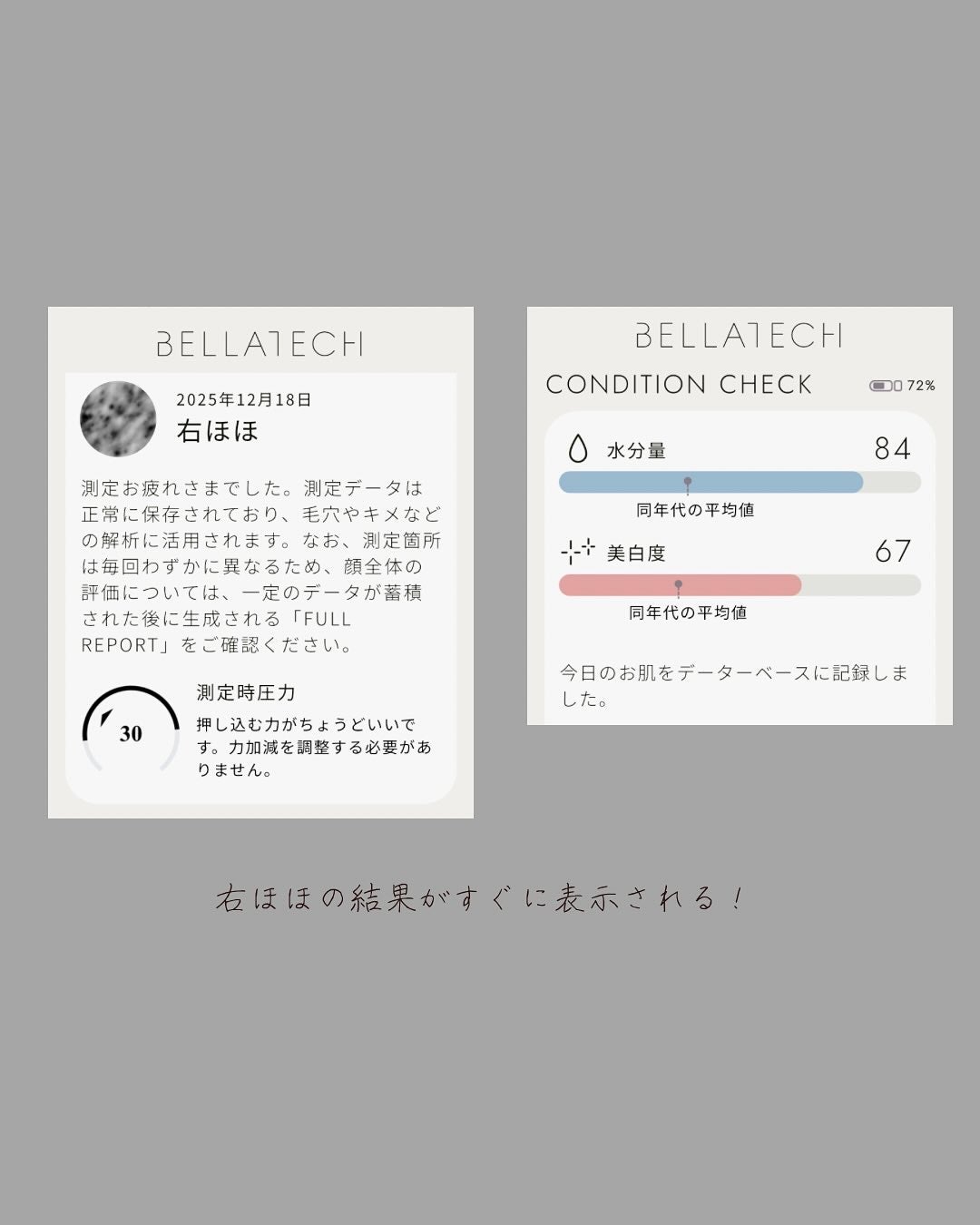 スキンスキャナー/BELLATECH/その他スキンケアグッズを使ったクチコミ(5枚目)