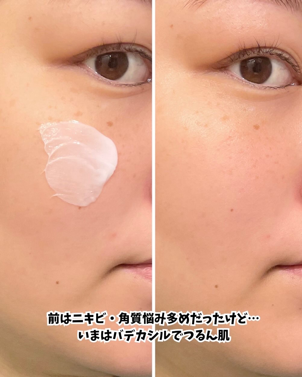 バデカシルDクリーム/23years old/フェイスクリームを使ったクチコミ（3枚目）