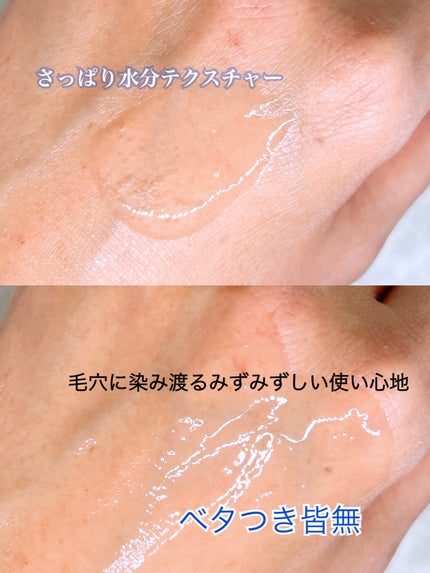 ã¡ãð on LIPS ãMEDIPEELãšã¯ã¹ãã©ã¹ãŒããŒ9ãã©ã¹æ¯ç©Žã¿ã€ããã³ã°ã¢ã³..ãïŒ3æç®ïŒ