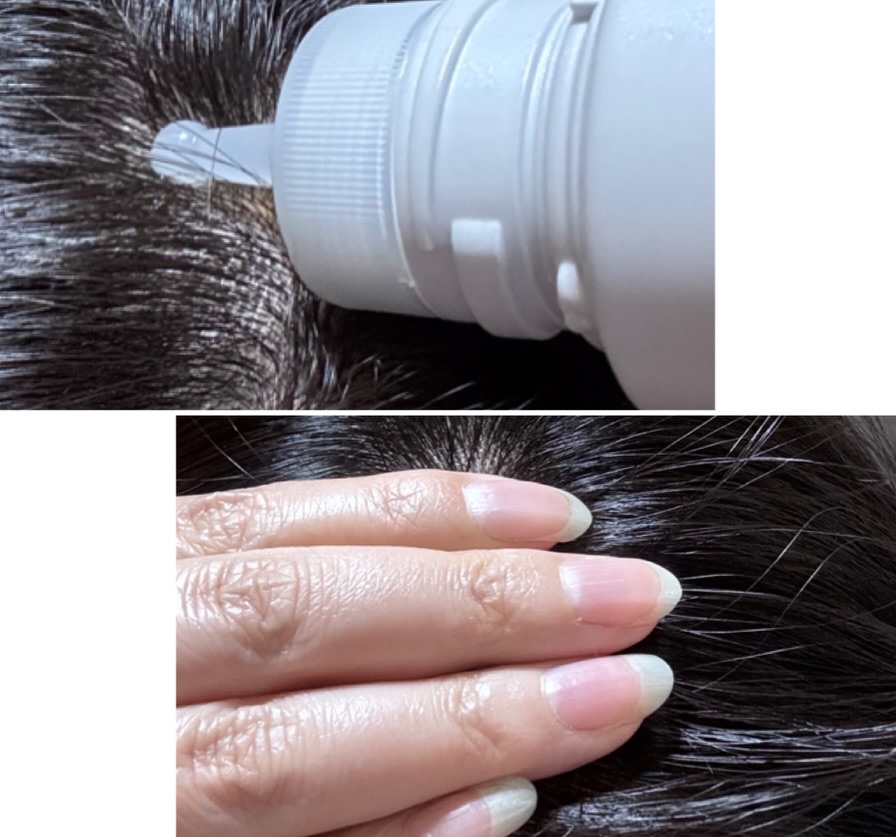 セグレタ 育毛エッセンス/花王/頭皮ローションを使ったクチコミ（3枚目）