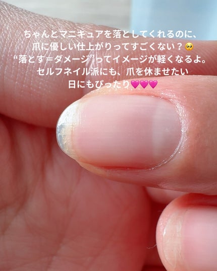 001 ヴィーガンティンテッドネイルハードナー/FOIND/ネイル用品を使ったクチコミ(6枚目)