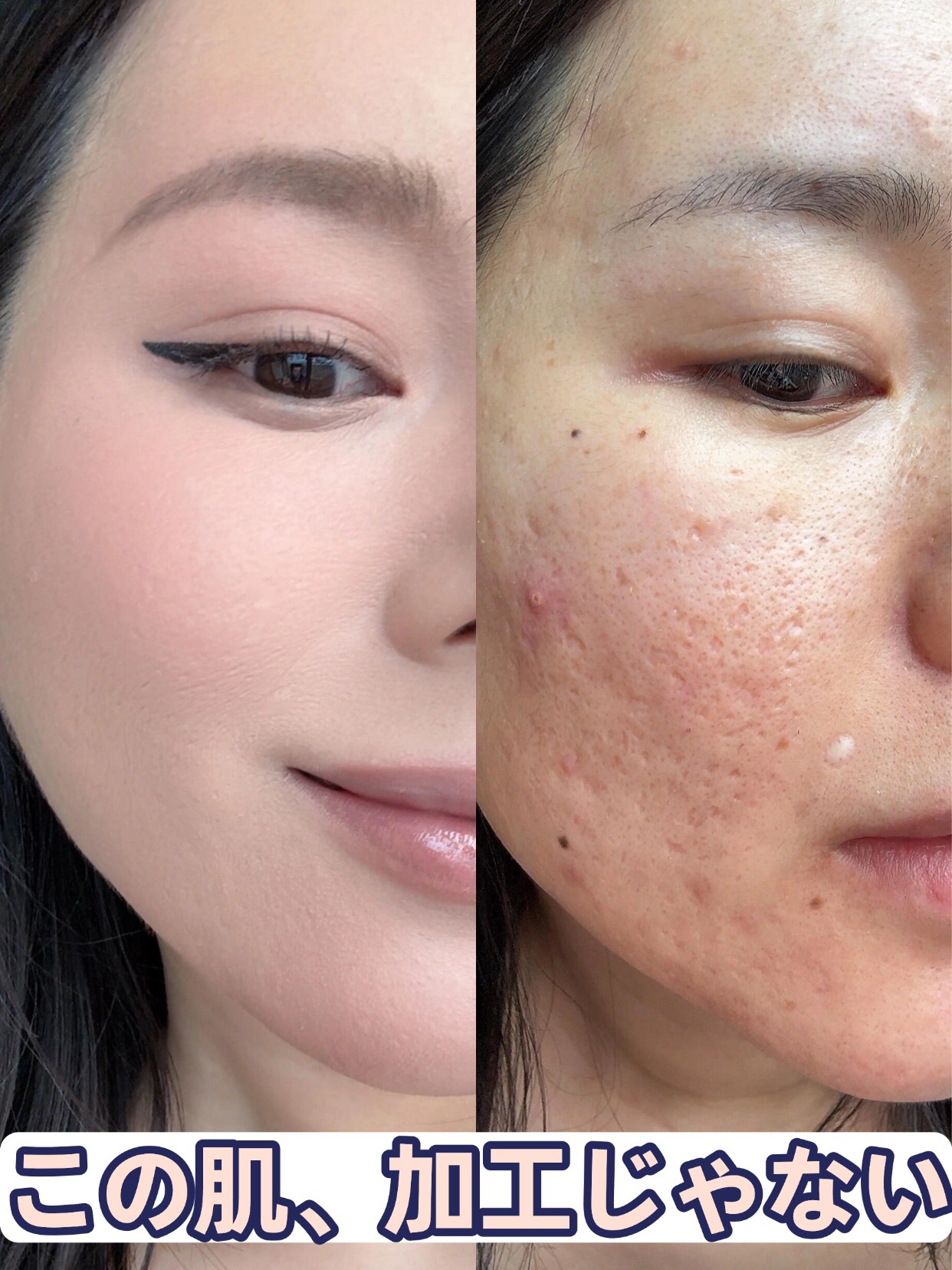 アネトス バランシング トリートメントクリーム/Anetos/フェイスクリームを使ったクチコミ（1枚目）