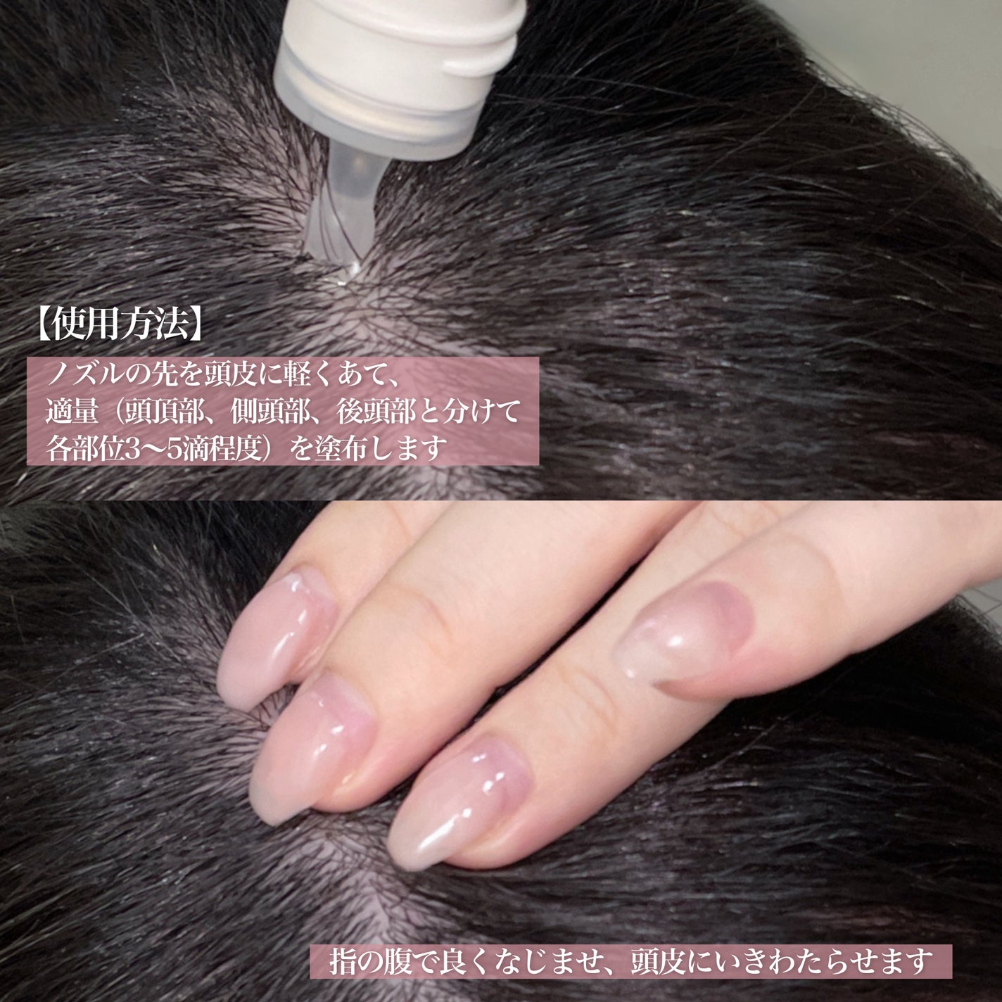 スカルプD ボーテ 薬用頭皮保湿美容液/アンファー(スカルプD)/頭皮ローションを使ったクチコミ(4枚目)