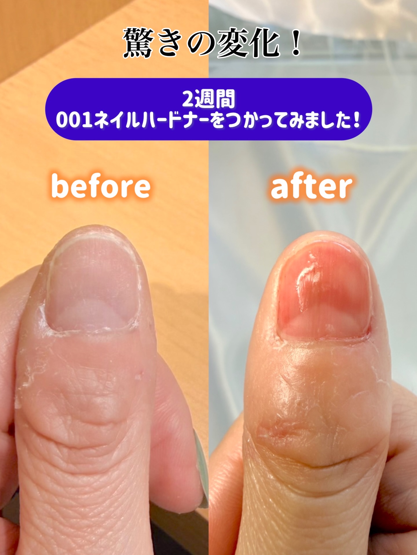 001 ヴィーガンティンテッドネイルハードナー/FOIND/ネイル用品を使ったクチコミ（2枚目）