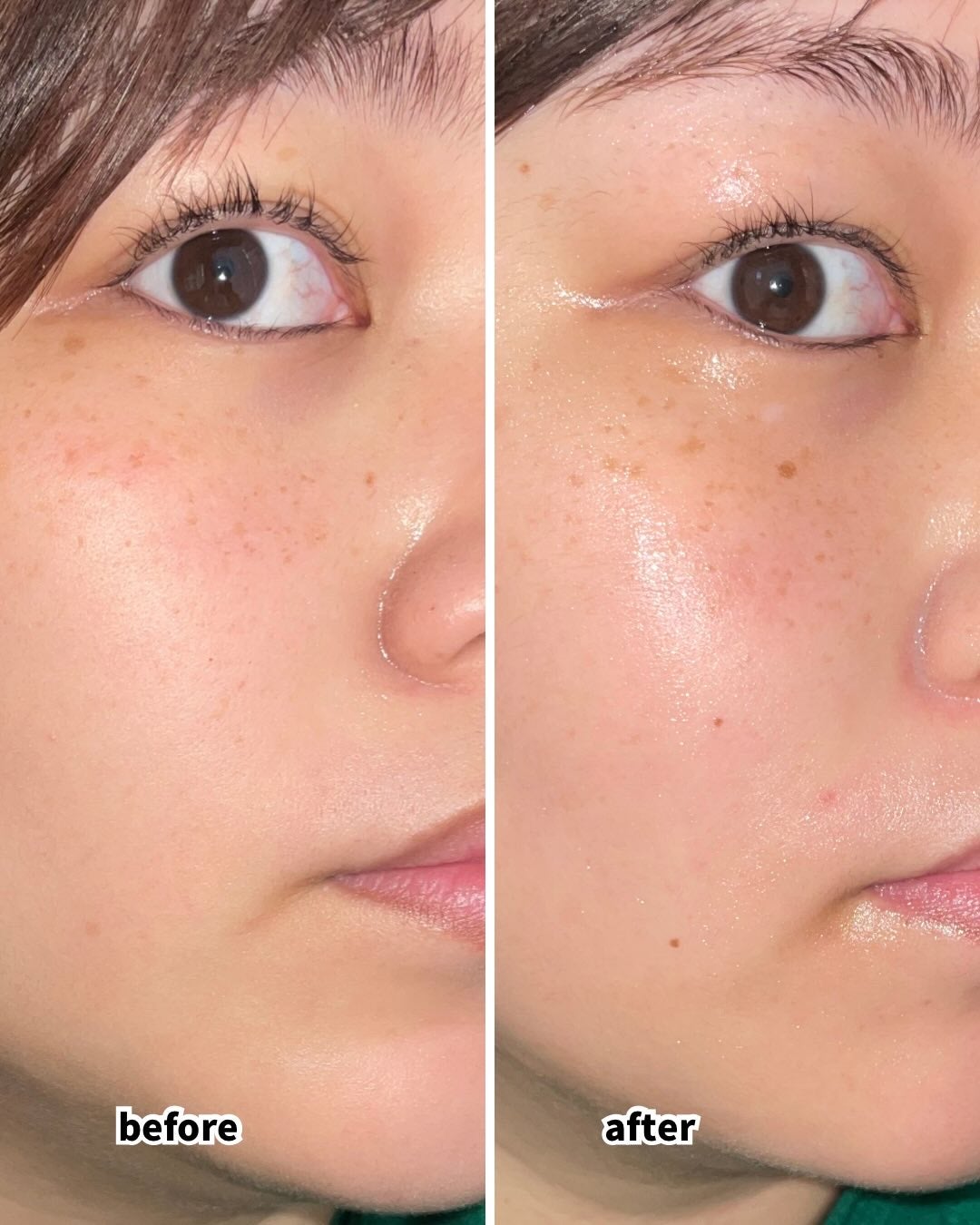 ReDRNエクソソームアンプル/Dr.nineteen/美容液を使ったクチコミ(3枚目)