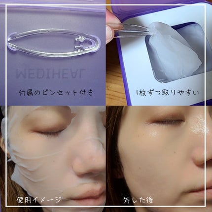 PDRN リフティングマスク/MEDIHEAL/シートマスク・パックを使ったクチコミ(2枚目)