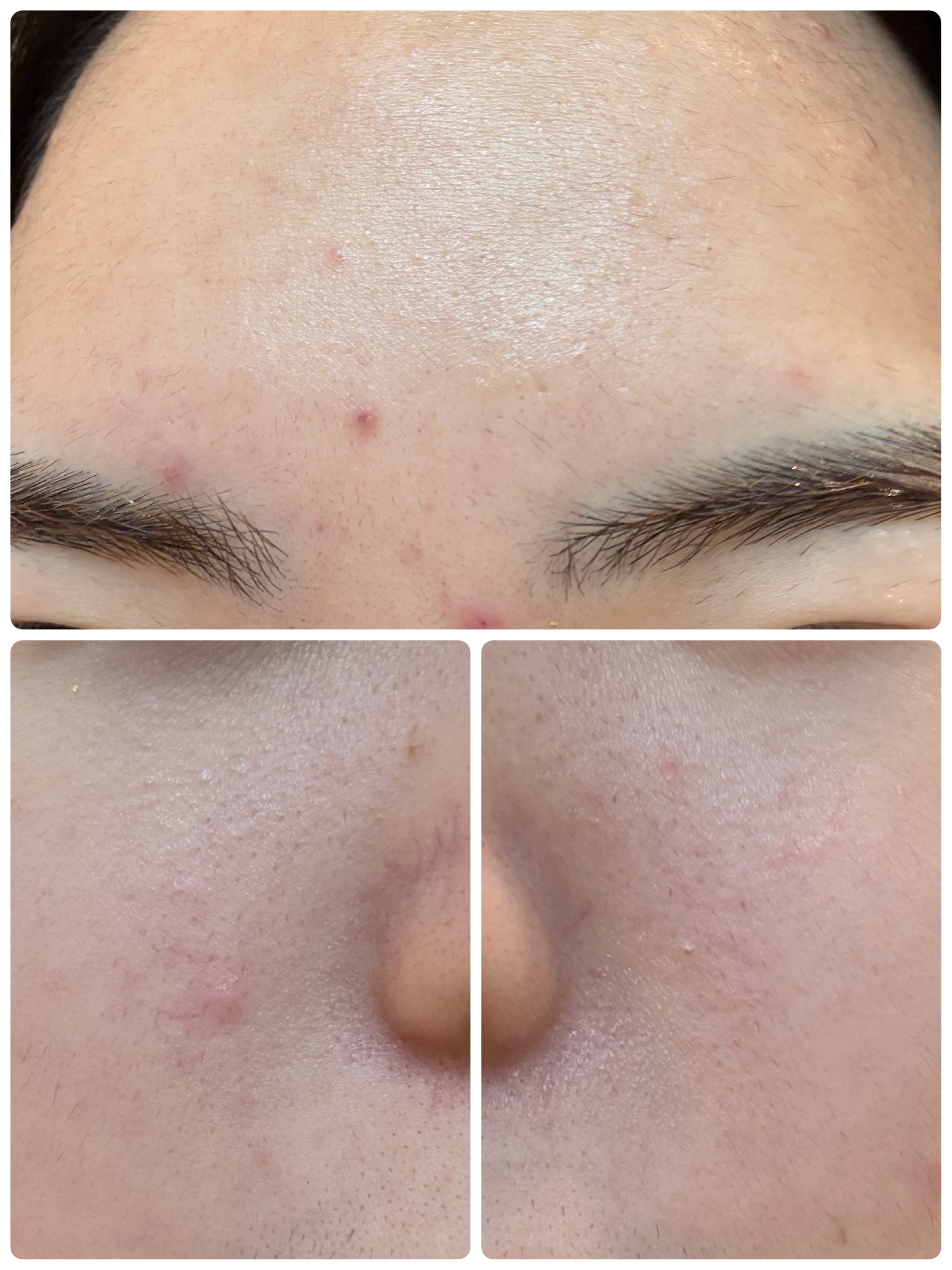 ディズム EMS EER メディスキンケアデバイス/DISM/美顔器・マッサージを使ったクチコミ（3枚目）