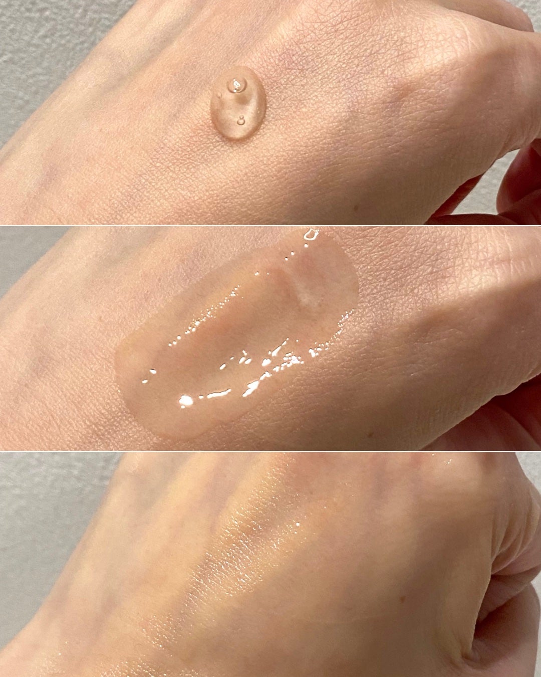 アネトス アクネケア トリートメント セラム/Anetos/美容液を使ったクチコミ(2枚目)