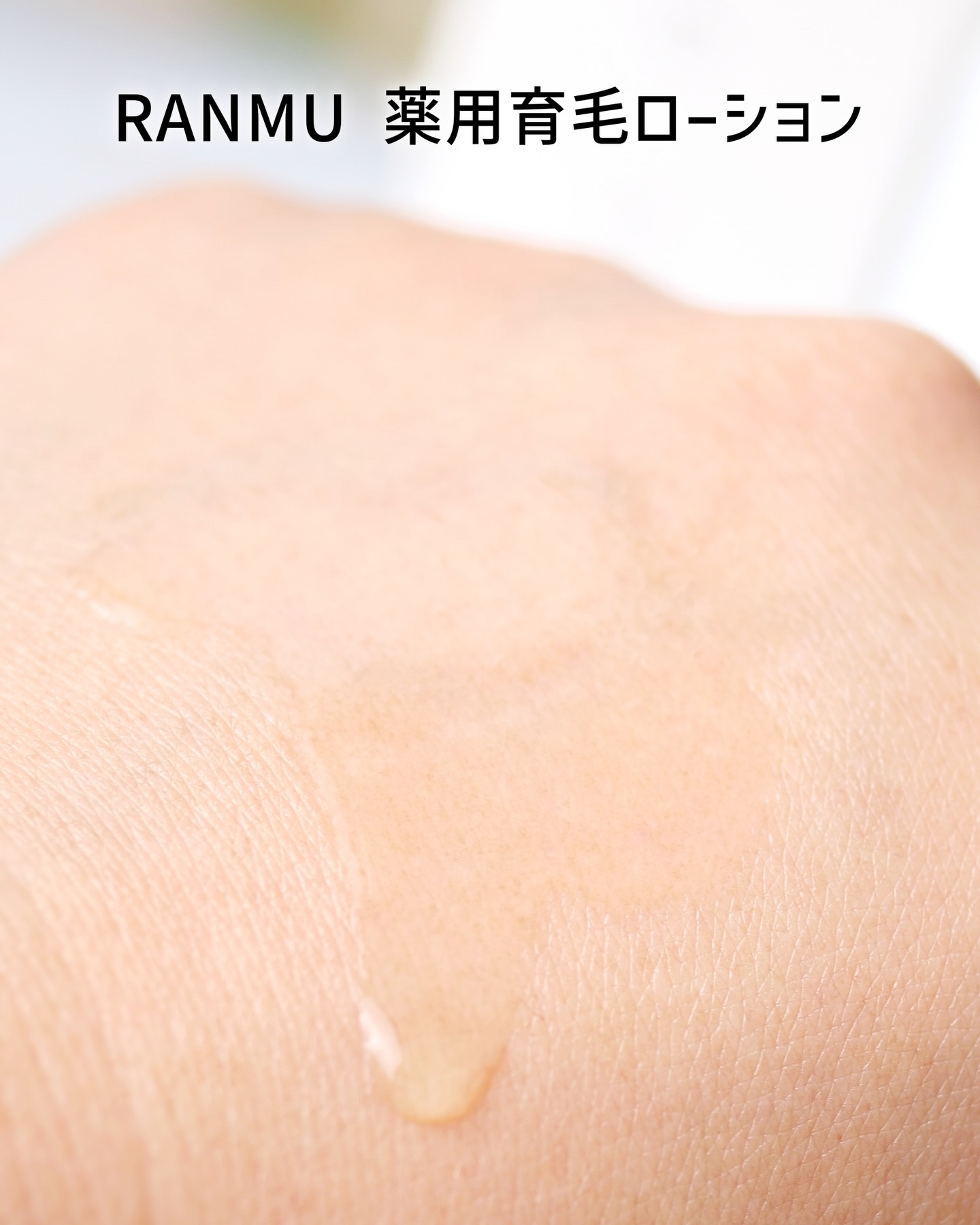 薬用育毛ローション　RANMU/RANMU/頭皮ローションを使ったクチコミ（3枚目）