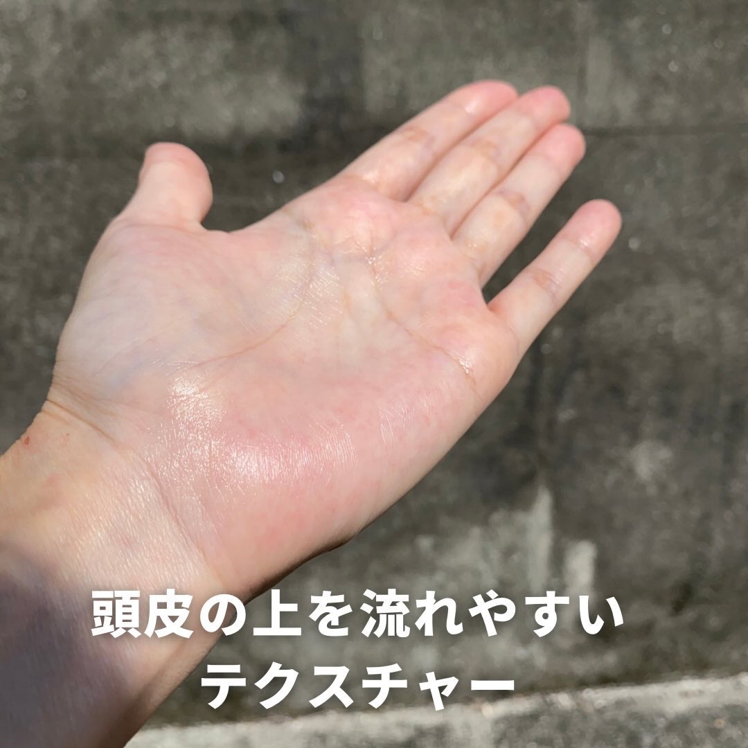 セグレタ 育毛エッセンス/花王/頭皮ローションを使ったクチコミ(7枚目)