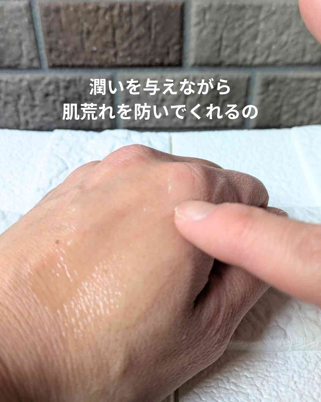 アネトス アクネケア トリートメント セラム/Anetos/美容液を使ったクチコミ（3枚目）