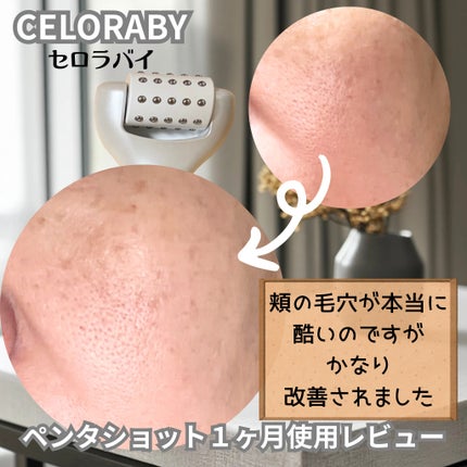 ペンタショット/CELORABY/美顔器・マッサージを使ったクチコミ(5枚目)