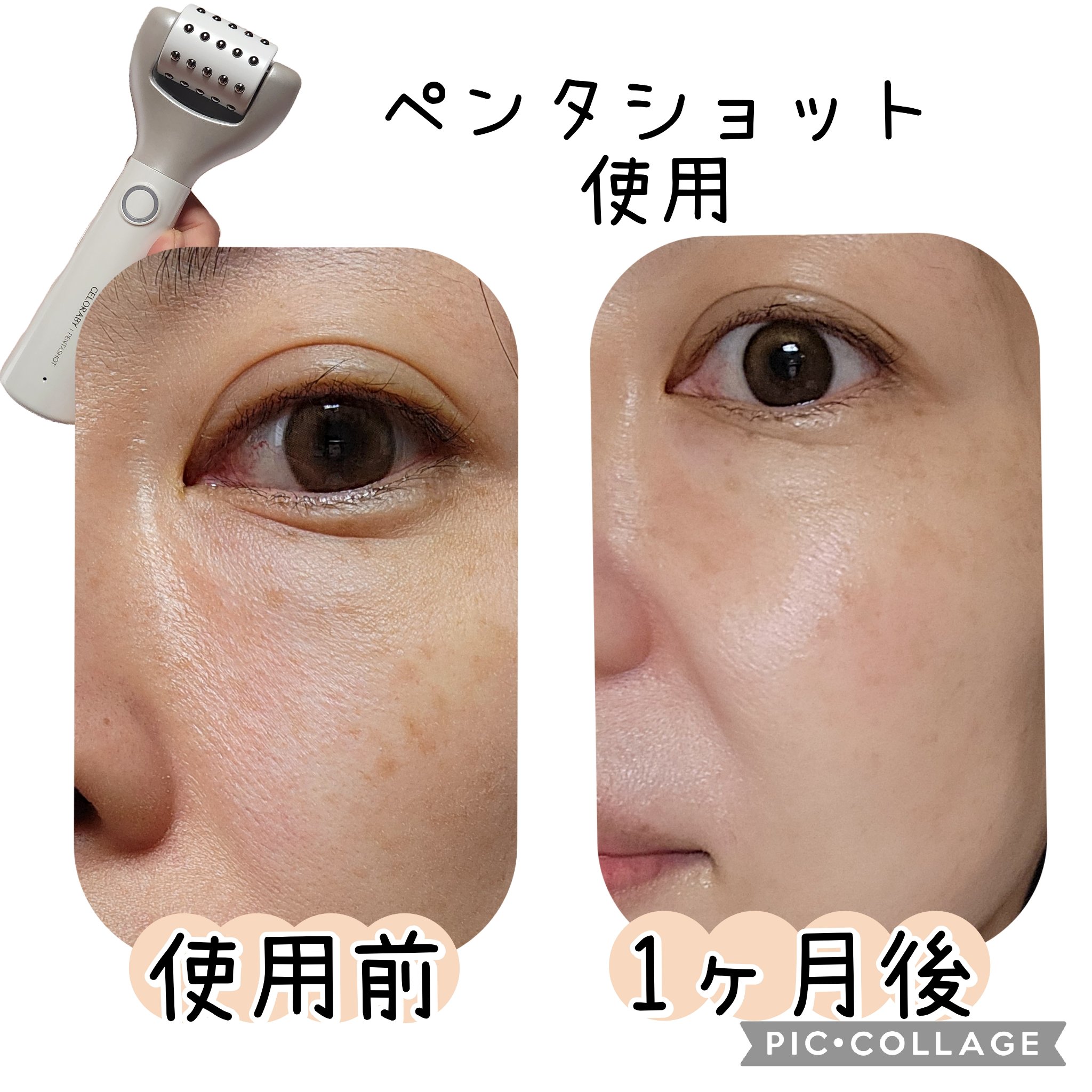 ペンタショット/CELORABY/美顔器・マッサージを使ったクチコミ（2枚目）