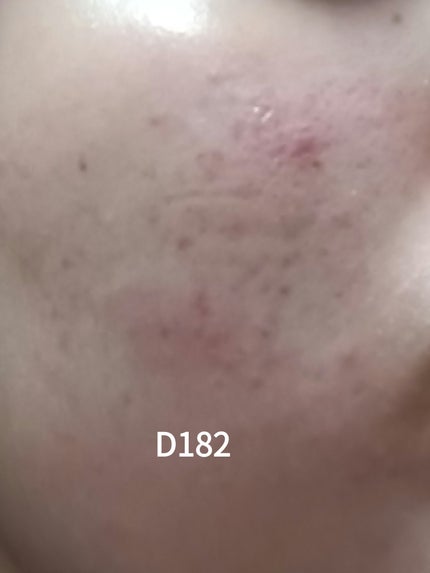 ã䜿ã£ãã¯ãã³ãïŒ1æç®ïŒ