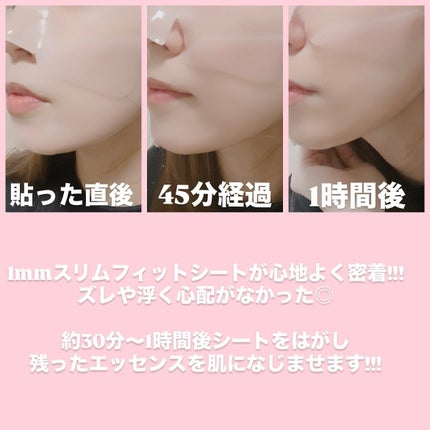 akari♡ on LIPS 「♥️SAM'U様よりPDRNリジュベネティングフルインハイドロ..」(2枚目)