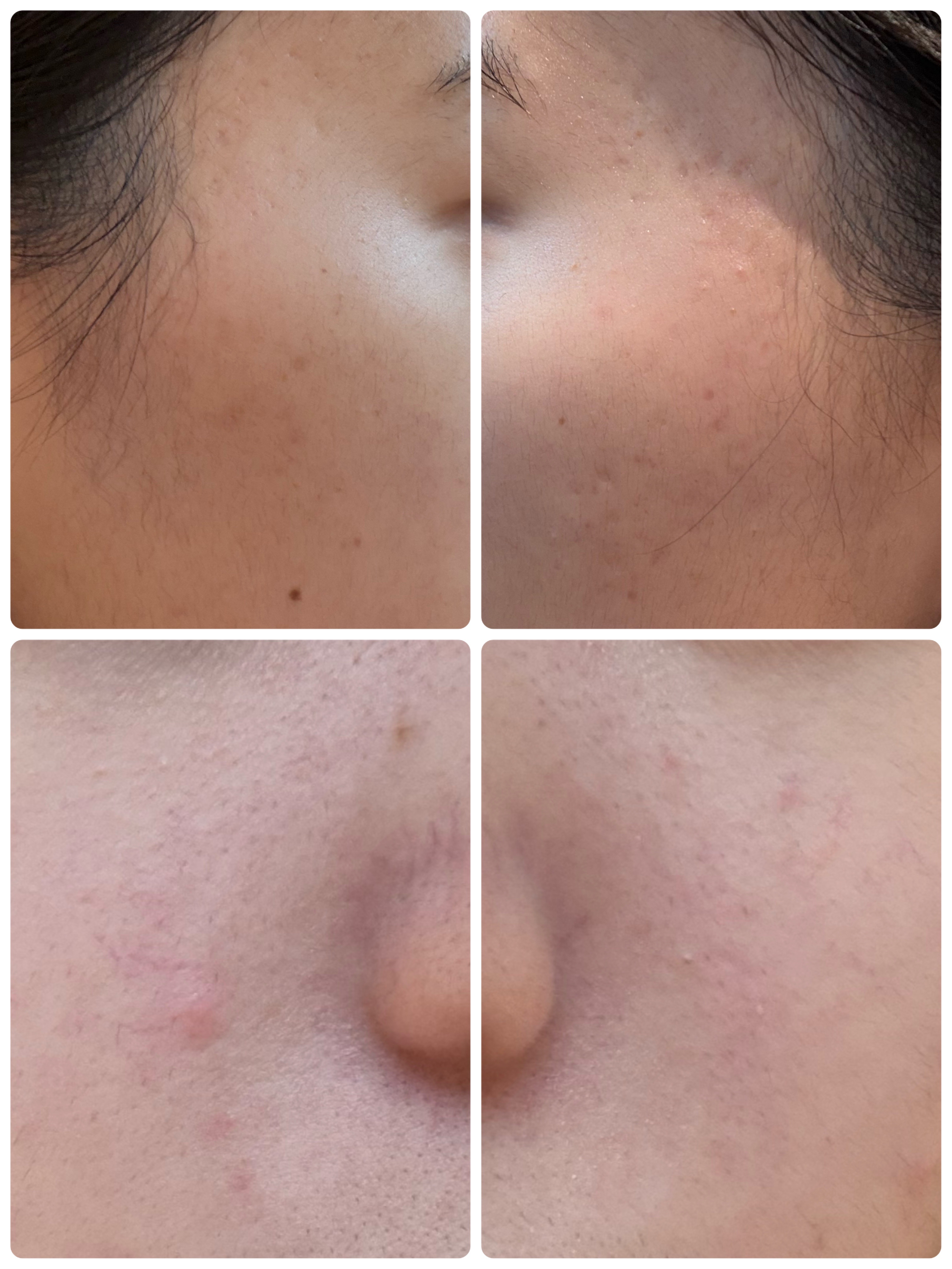 ディズム EMS EER メディスキンケアデバイス/DISM/美顔器・マッサージを使ったクチコミ（2枚目）