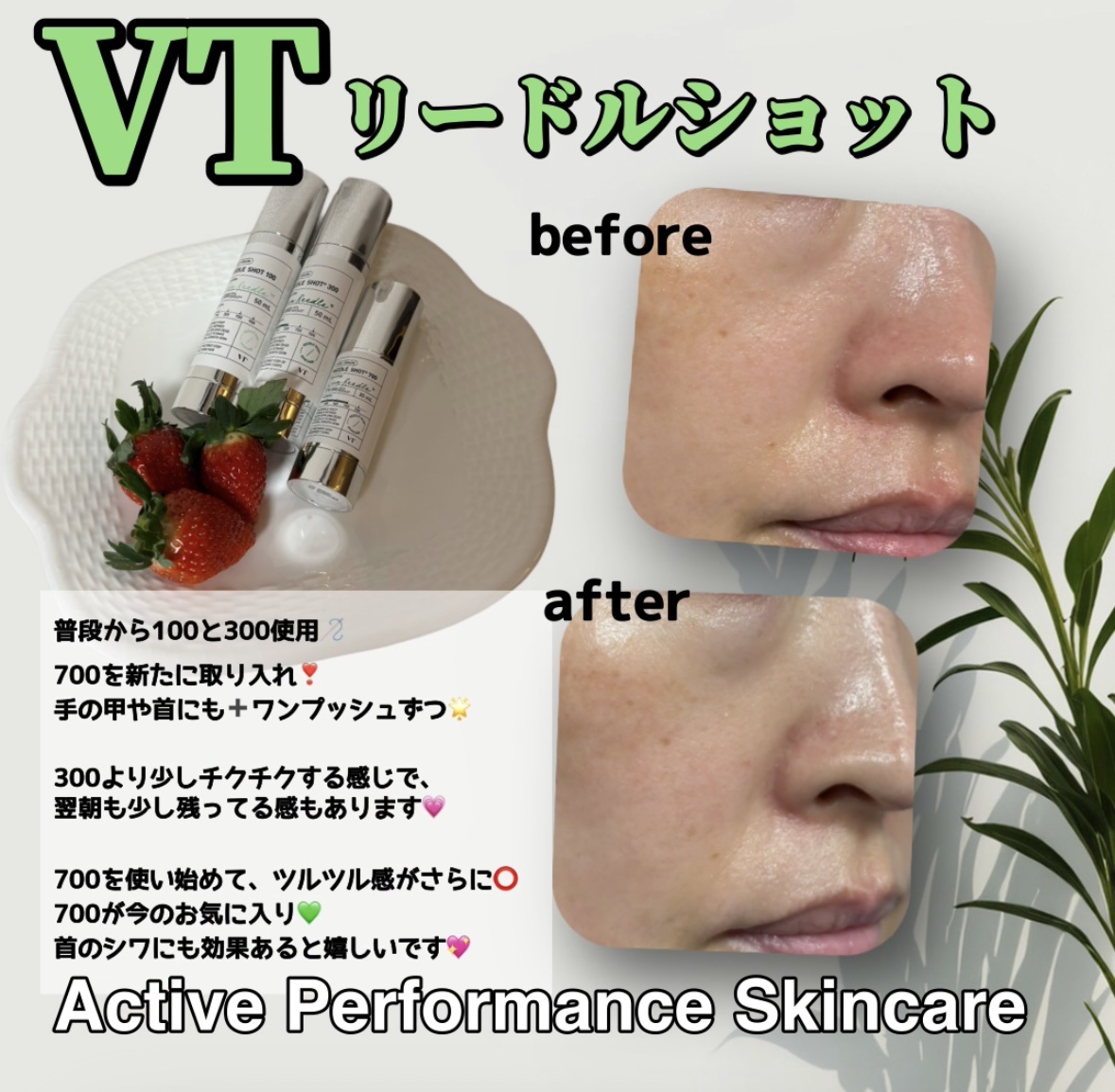 リードルショット300/VT/美容液を使ったクチコミ（3枚目）