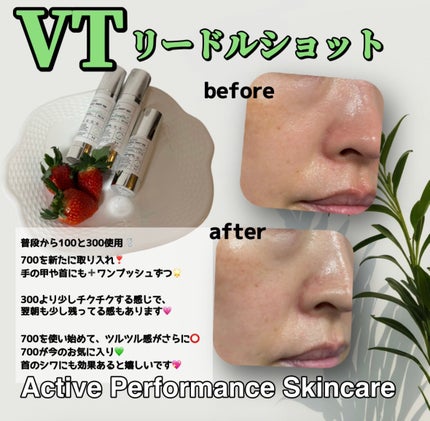 リードルショット300/VT/美容液を使ったクチコミ(3枚目)