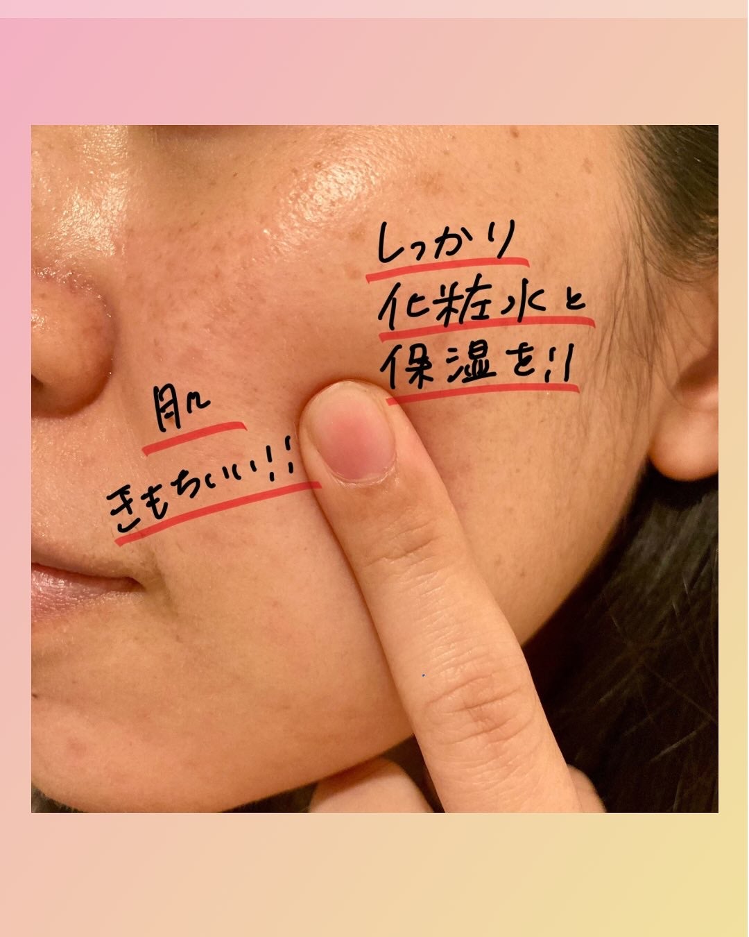 プラズマショットブースター/manyo/美顔器・マッサージを使ったクチコミ(5枚目)