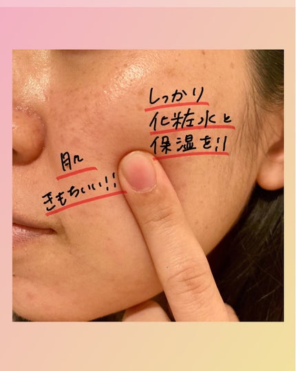 プラズマショットブースター/manyo/美顔器・マッサージを使ったクチコミ(5枚目)