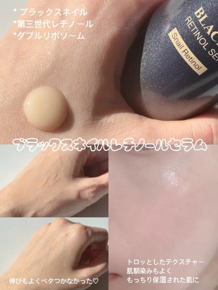 ブラックスネイル クリーム/Dr.G/フェイスクリームを使ったクチコミ(2枚目)