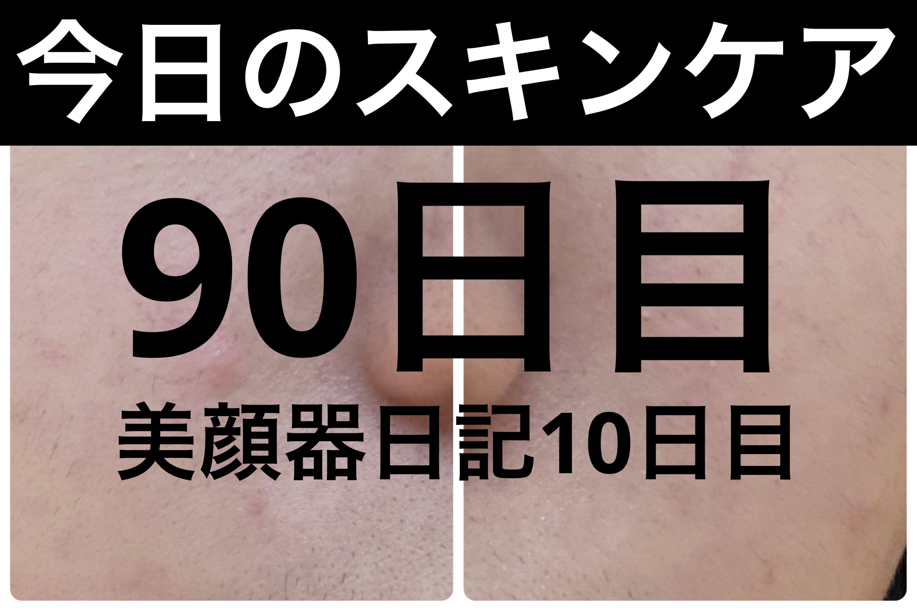 ディズム EMS EER メディスキンケアデバイス/DISM/美顔器・マッサージを使ったクチコミ（1枚目）