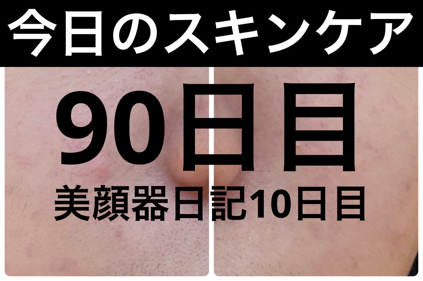 モーニングジェルウォッシュ/ビトレスキン/その他洗顔料を使ったクチコミ(1枚目)