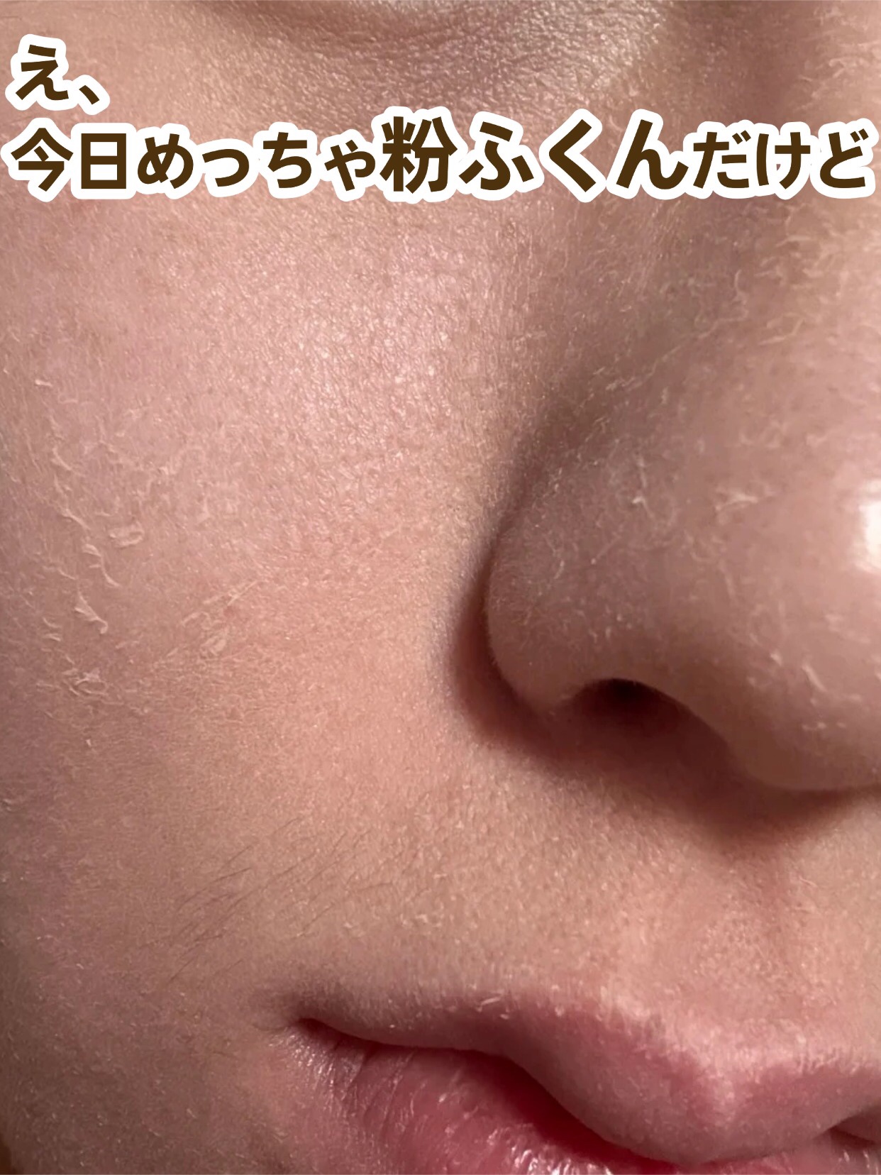 アネトス バランシング トリートメントクリーム/Anetos/フェイスクリームを使ったクチコミ（1枚目）