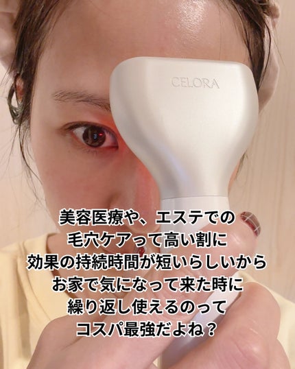 まるみ♡ on LIPS 「この美顔器はヤバい🤯⚡️まずは、私の話なんかより公式さんのペー..」(9枚目)