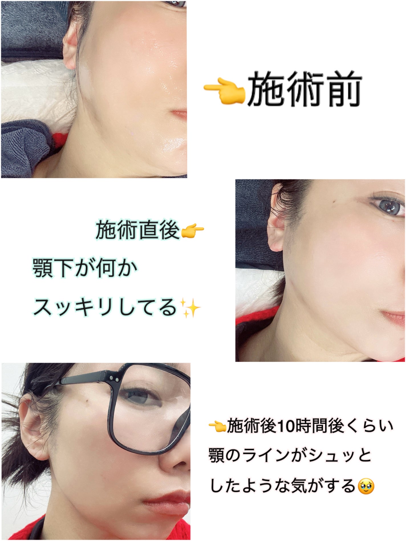 ã¡ãð on LIPS ããéåœããç¡äºåž°åœð°ð·âïžð¯ðµãæ±åã®ãŽãŒã«ãã³ãã©ã³ã¹ã§ãªã³..ãïŒ3æç®ïŒ