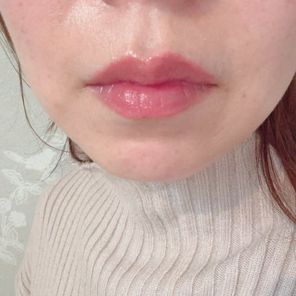 レチナールリップバーム/Dr.Different/リップバームを使ったクチコミ(3枚目)